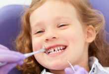 Dental Crowns and Pediatric Dentist